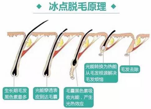 春季怎么搭配衣服不会感冒