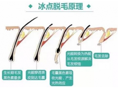 春季怎么搭配衣服不会感冒